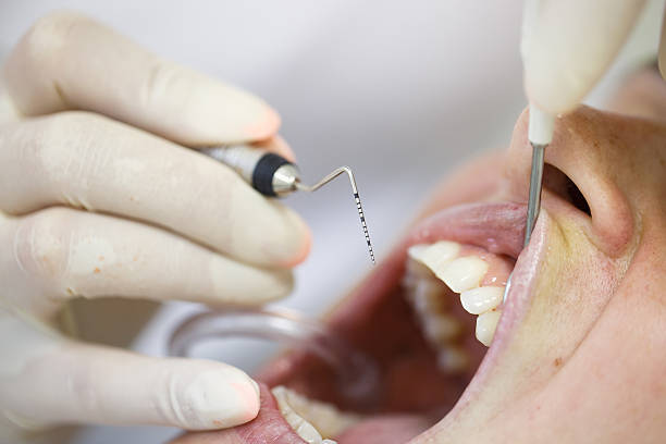 periodontal treatment gum disease