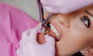 Why Top Ryde Dentists Is Ryde’s Go-To Clinic for Dental Implants